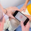 Skin cancer AI app