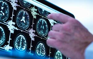 MRI scan