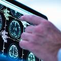 MRI scan