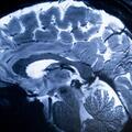 Brain during MRI scan